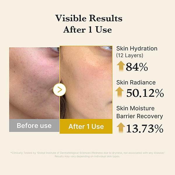میست سرم ژلی کوجیک اسید و زردچوبه مدی کیوب Medicube Kojic Acid Turmeric Vita Jelly Mist Serum 100Ml - Image 7