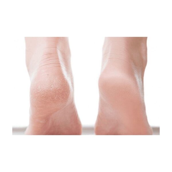 کرم ترک پا و ترمیم کننده قوی پا نوتروژینا Neutrogena Intense Repairing Foot Balm 50 Ml