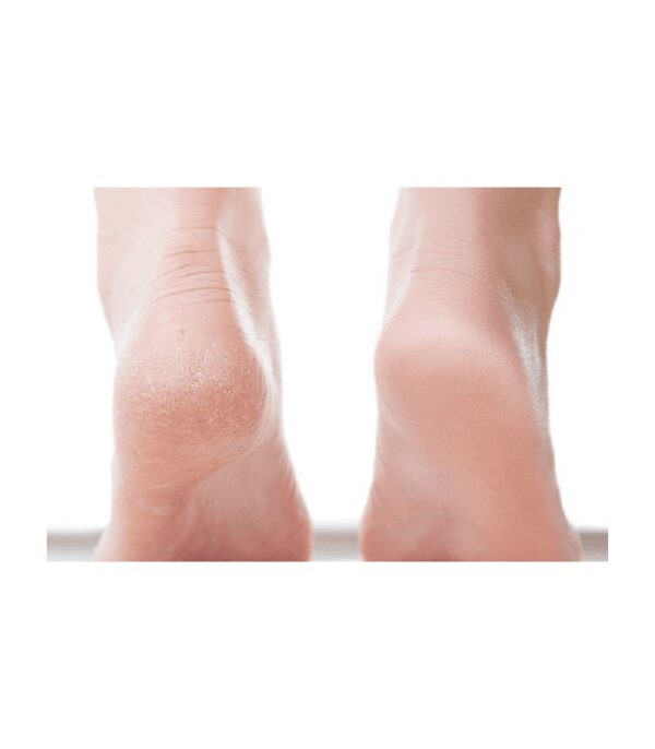 کرم ترک پا و ترمیم کننده قوی پا نوتروژینا Neutrogena Intense Repairing Foot Balm 50 Ml