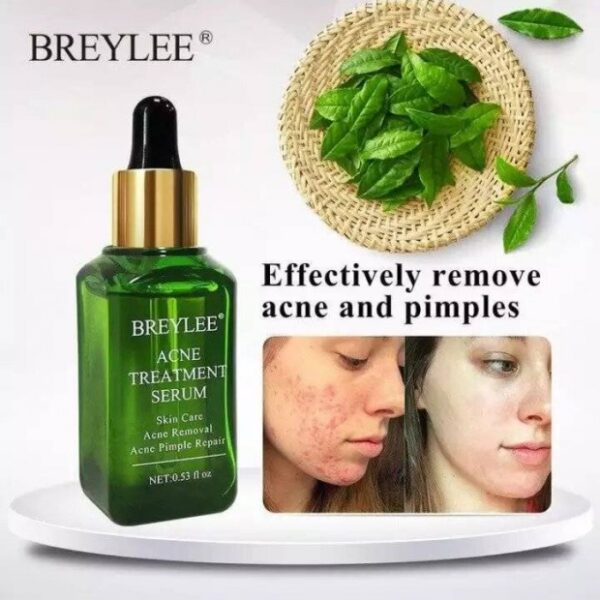 سرم درمان کننده ضد جوش صورت گیاه چای سبز بریلی Breylee serum